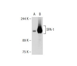 SPA-1 (3): sc-136189. Western blot analysis of SPA-1 expression in... 