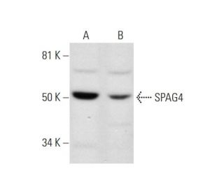 SPAG4 Antibody (H-6) - Western Blotting - Image 292092 