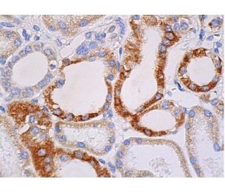 SPARC Antibody (D-2) - Immunohistochemistry - Image 370159 