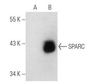 SPARC Antibody (AON-5031) - Western Blotting - Image 37046 