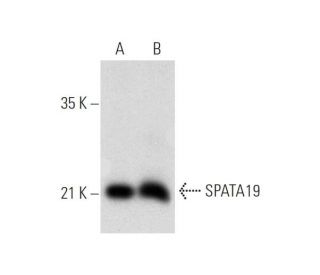 SPATA19 Antibody (B-9) - Western Blotting - Image 319617 