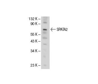 SPATA2 Antibody (EE-31) - Western Blotting - Image 52170 