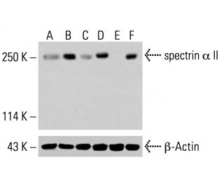 spectrin α II Antibody (B-2) - Western Blotting - Image 414850Each CRISPR/Cas9 Knockout (KO) Plasmid product consists of a pool of 3 plasmids designed to ensure identification and cleavage of a specific gene for maximum knockout efficiency. Each plasmid encodes a unique 20 nt sequence derived from the GeCKO (v2) library.