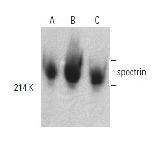 spectrin Antibody (RG/26) - Western Blotting - Image 398871 