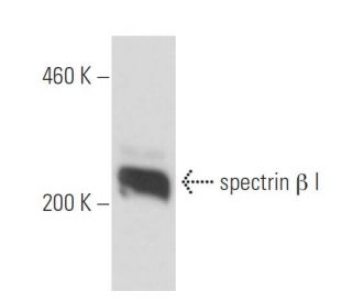 spectrin &beta; I Antibody (4C3) - Western Blotting - Image 15578