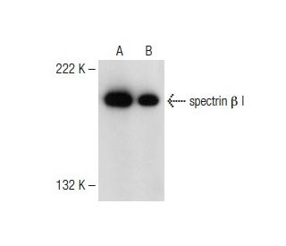spectrin &beta; I Antibody (B-1) - Western Blotting - Image 149685 