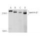 spectrin β I Antibody (D-6) - Western Blotting - Image 357958 