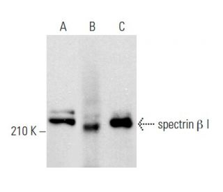spectrin &beta; I Antibody (VD4) - Western Blotting - Image 357964 