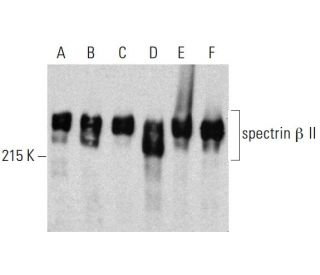 spectrin &beta; II Antibody (42) - Western Blotting - Image 386084 