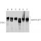 spectrin β II Antibody (42) - Western Blotting - Image 386084 
