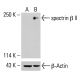 spectrin β II Antibody (G-10) - Western Blotting - Image 414521 