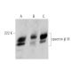 spectrin β III Antibody (A-8) - Western Blotting - Image 360052