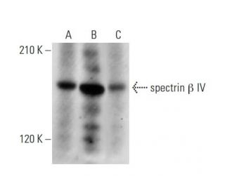 spectrin &beta; IV Antibody (D-7) - Western Blotting - Image 331151 