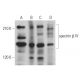 spectrin β IV Antibody (D-7) - Western Blotting - Image 364320