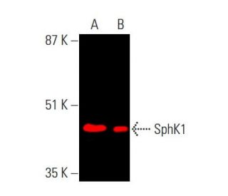 SphK1 Antibody (G-11) - Western Blotting - Image 378914