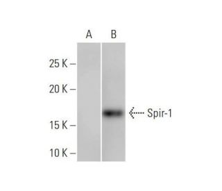 Spir-1 Antibody (4C5) - Western Blotting - Image 352202 