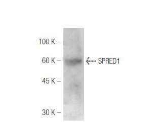 SPRED1 Antibody (M23-P2G3) - Western Blotting - Image 47840 