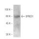 SPRED1 Antibody (M23-P2G3) - Western Blotting - Image 47840 