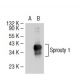 Sprouty 1 Antibody (RR-15) - Western Blotting - Image 38287