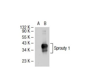 Sprouty 1 Antibody (RR-15) - Western Blotting - Image 38287Each CRISPR/Cas9 Knockout (KO) Plasmid product consists of a pool of 3 plasmids designed to ensure identification and cleavage of a specific gene for maximum knockout efficiency. Each plasmid encodes a unique 20 nt sequence derived from the GeCKO (v2) library. 