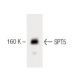 SPT5 Antibody (17) - Western Blotting - Image 60444 
