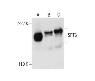 SPT6 Antibody (C-6) - Western Blotting - Image 299227 