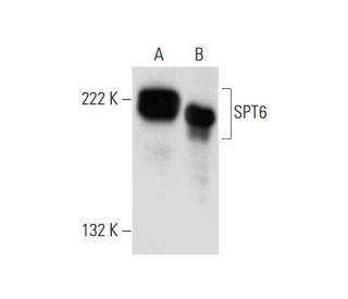 SPT6 Antibody (E-4) - Western Blotting - Image 299205 