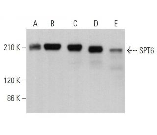 SPT6 Antibody (E-4) - Western Blotting - Image 366602 