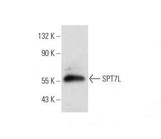 SPT7L Antibody (F-5) - Western Blotting - Image 320959 