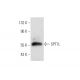 SPT7L Antibody (F-5) - Western Blotting - Image 320959 