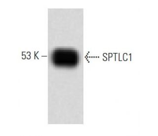 SPTLC1 Antibody (49) - Western Blotting - Image 60210
