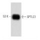 SPTLC1 Antibody (49) - Western Blotting - Image 60210