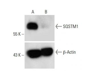 SQSTM1 CRISPR/CAS9 KO Plasmid (h): sc-400099. Western blot analysis of SQSTM1 expression in empty vector control (A) and S 