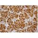 Squalene synthetase Antibody (C-10) - Immunohistochemistry - Image 159961 