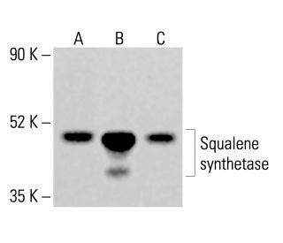 Squalene synthetase Antibody (A-7) - Western Blotting - Image 414059