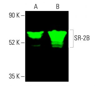 SR-2B Antibody (C-6) - Western Blotting - Image 403898 