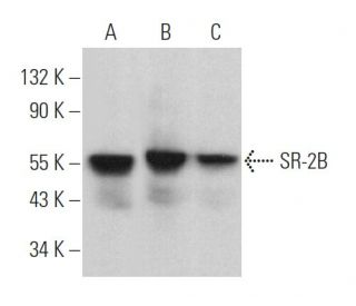 SR-2B Antibody (H-11) - Western Blotting - Image 368432 