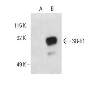 SR-B1 Antibody (F-12) - Western Blotting - Image 397681SAM Transcription Activation: SAM system utilizing dCas9-VP64, MS2-P65-HSF1, and sgRNA for precise gene transcription activation.