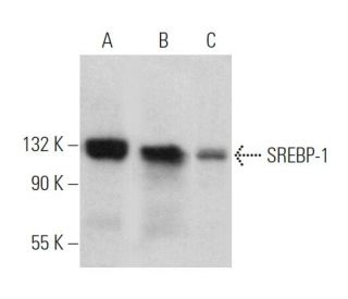 SREBP-1 Antibody (3F335) - Western Blotting - Image 360376 