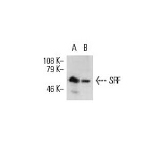 serum reponse factor /SRF Antibody (A-11) - Western Blotting - Image 8678 