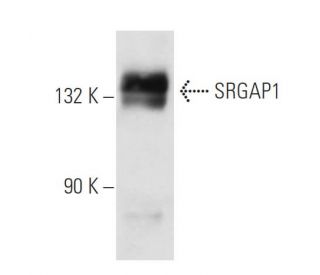SRGAP1 Antibody (SQ-6) - Western Blotting - Image 31599 