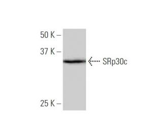 SRp30c Antibody (1G7) - Western Blotting - Image 347594SAM Transcription Activation: SAM system utilizing dCas9-VP64, MS2-P65-HSF1, and sgRNA for precise gene transcription activation.