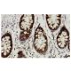 SRPK1 Antibody (EE-13) - Immunohistochemistry - Image 36025