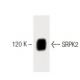 SRPK2 Antibody (23) - Western Blotting - Image 60446 