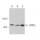 SRPK2 Antibody (A-5) - Western Blotting - Image 380837 