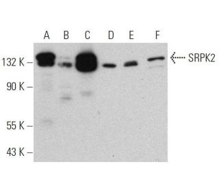 SRPK2 Antibody (H-5) - Western Blotting - Image 359382 