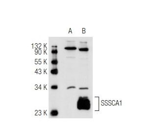 SSSCA1 Antibody (NB-C27) - Western Blotting - Image 82525 