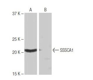 SSSCA1 Antibody (NB-C27) - Western Blotting - Image 65063