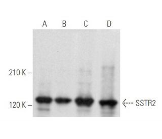 SSTR2 Antibody (A-8) - Western Blotting - Image 355567 