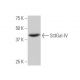 St3Gal-IV Antibody (1F4) - Western Blotting - Image 347576